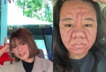 Wajah Berubah Saat Hamil? Kisah Ibu Hamil Ini Bikin Terharu