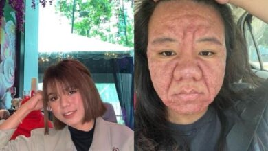 Wajah Berubah Saat Hamil? Kisah Ibu Hamil Ini Bikin Terharu