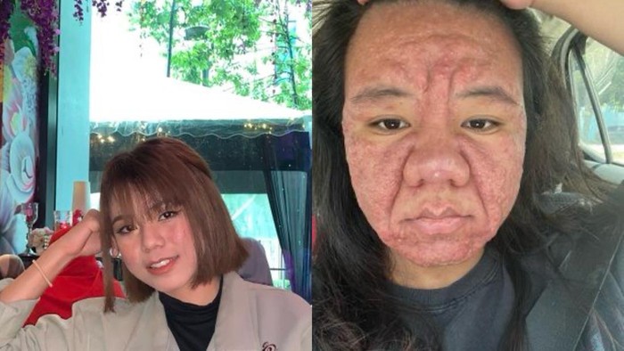 Wajah Berubah Saat Hamil? Kisah Ibu Hamil Ini Bikin Terharu